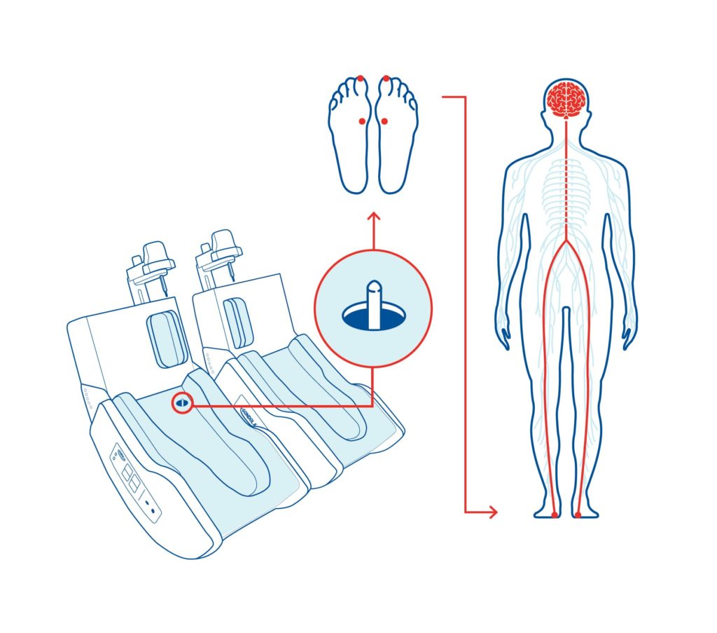 How the Gondola AMPS impacts on brain improving walking impairments